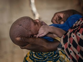 A mother holding her young baby at one of the Unicef nutrition clinics  in Borno State, northeastern Nigeria.