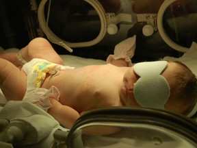 A newborn baby, with jaundice, under bilirubin lights.
