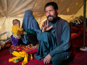 An Afghan man, Mohammad Azam, 45, and father of Zahra, 14, who is dead after she was set on fire in her husband's home, talks during an interview in a tenet in Kabul, Afghanistan, Monday, July 18, 2016