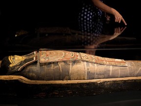 Israel's national museum is set to display a 2,200-year-old Egyptian mummy who was burdened with some modern-day afflictions.