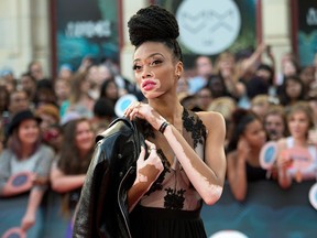 Winnie Harlow arrives on the red carpet at the 2014 Much Music Video Awards in Toronto in a file photo.