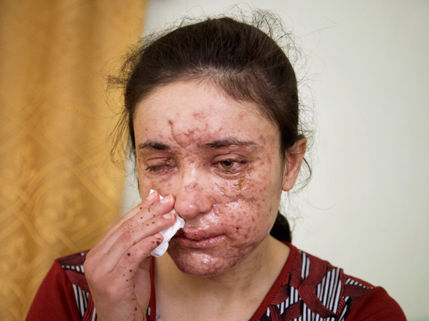 Hardkor lezbiyen jinsiy aloqa