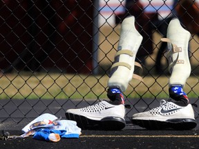 In this Monday, Aug. 1, 2016, photo, the prosthetic legs of paralympian runner A.J. Digby lean against a fence as he practices at the Eastwood High School track in Pemberville, Ohio.