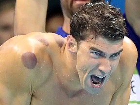 Don't be alarmed when you see Michael Phelps covered in strange purple bruises.