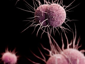 Drug-resistant Neisseria gonorrhoeae diplococcal bacteria, which causes gonorrhea, the second most common infectious disease in the United States.