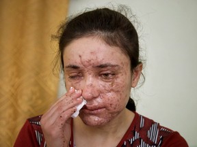 Lamiya Aji Bashar was wounded by a land mine while fleeing sexual slavery under ISIL forces.