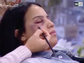 The Moroccan TV channel 2M outraged viewers by airing a tutorial on how to hide bruises.