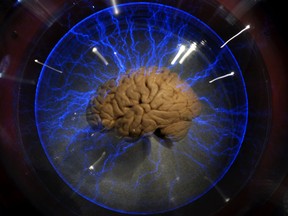 A human brain is displayed inside a glass box in Sao Paulo, Brazil.
