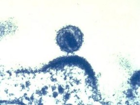 This Feb. 3, 2012 microscope image made available by the National Institute of Allergy and Infectious Diseases shows a human immunodeficiency virus (HIV) budding out of a human immune cell, which the virus infects and uses to replicate.