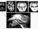 Macaque MRIs used to convert the monkey's skull diameter measurements to create a vocal tract model.