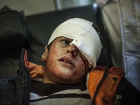Yousef Oday, 10, who was wounded in the eye by ISIL militants, is treated by doctors at the al-Zahra clinic in Mosul, Iraq on Dec. 7.