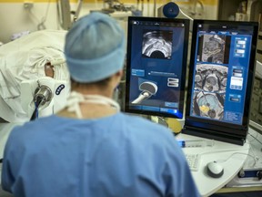 A surgeon in Lyon, France conducts prostate cancer surgery. A newly published Canadian study suggests that having advanced male-pattern baldness strongly predicts risk of prostate cancer.