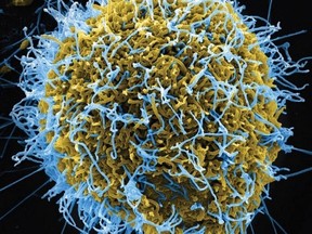 An electron micrograph scan shows the Ebola virus emerging from an infected cell. MUST CREDIT: Handout courtesy of NIAID/NIH
Handout, Handout