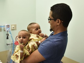 Marino Abel Camacho holds his conjoined daughters, Ballenie and Bellanie Camacho before surgery at Maria Fareri Children's Hospital in Valhalla, N.Y. on Nov. 2, 2016.