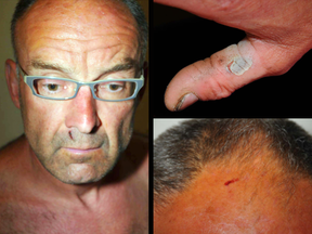 Photos of Douglas Garland after his arrest in July 2014 show various cuts and bruises.