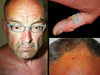 Photos of Douglas Garland after his arrest in July 2014 show various cuts and bruises.