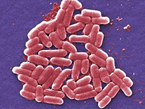An electron micrograph image of E. coli bacteria. The semi-synthetic E. coli microbes are not pictured.