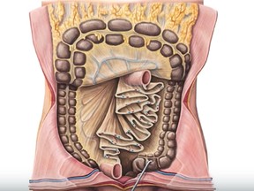 Next to the thumping heart and the brain's enigmatic mass, the mesentery may seem a humble thing. It is a fatty membrane that holds the intestines in place.
