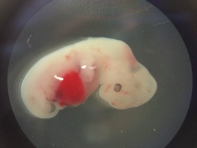 A 4-week-old pig embryo that was injected with human stem cells. The experiment was a very early step toward the possibility of growing human organs inside animals for transplantation.