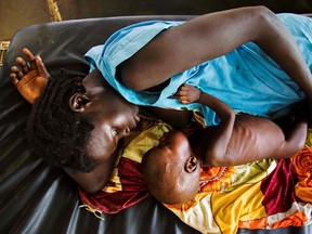 This file photo taken on October 11, 2016 shows a mother breastfeeding her child who suffers acute malnutrition at the clinic run by Doctors Without Borders (MSF) in Aweil, northern Bahr al-Ghazal, South Sudan.  ]South Sudan's government said on February 20, 2017, that the country's over three-year war has led to famine in parts of the nation, while nearly half the population was going hungry.
