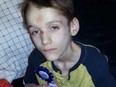Alex Radita is shown in a photo from his 15th birthday party, three months before his death.