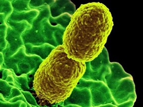 Two mustard-colored, rod-shaped carbapenem-resistant Klebsiella pneumonias bacteria are part of the family of germs known as Enterobacteriaceae.