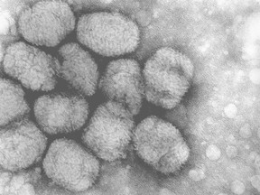 A transmission electron micrograph of smallpox viruses.
