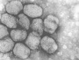 A transmission electron micrograph of smallpox viruses.