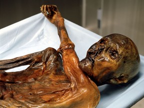 An undated handout file photo shows "Otzi", Italy's prehistoric iceman. "Otzi", Italy's prehistoric iceman, as likely killed by an arrow shot from a distance away, researchers have found.