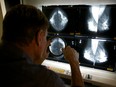 A radiologist examines a mammogram.