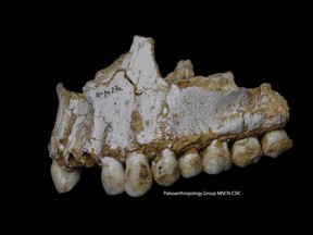 The upper jaw from an El Sidron Neanderthal. This individual was eating poplar, a source of aspirin, and had also consumed mouldy vegetation including Penicillium fungus, source of a natural antibiotic.