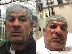 Kamal Nayfeh, a North Carolina college instructor, was beaten at a March 26 protest in Washington DC. Among those charged is a Toronto man associated with the Jewish Defence League's Canadian branch