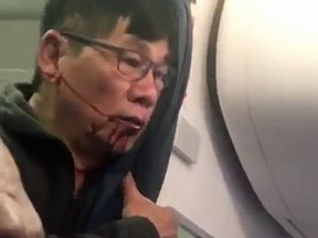 The unnamed man dragged from an overbooked United flight at Chicago O'Hare was photographed bleeding from the mouth.