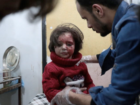 A Syrian girl receives treatment at a makeshift clinic following reported air strikes by government forces in the rebel-held town of Douma, on the eastern outskirts of Damascus, on April 4, 2017.