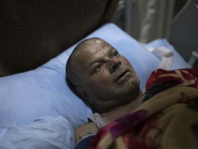 Ali Zanoun, one of the only survivors of a U.S. strike on a building in Mosul, lies on his bed as he waits for another surgery at a hospital in Irbil, Iraq