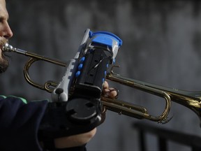 In this Tuesday, May 30, 2017 photo, Juan Pablo Pelaez plays his trumpet using his new prosthetic arm, in Buenos Aires, Argentina. "It's something that's good for your soul," he said. "Knowing that technology can help achieve these kinds of things, is wonderful." (AP Photo/Natacha Pisarenko)