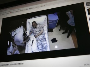 In this Thursday, June 29, 2017, photo, a video clip shows China's jailed Nobel Peace laureate Liu Xiaobo lying on a bed receiving medical treatment at a hospital on a computer screen in Beijing. China says it has invited U.S. and German liver cancer experts to join a medical team treating imprisoned Liu. The judicial bureau for the northeastern city of Shenyang said Wednesday, July 5, 2017, in an online statement that Liu's family members made a request for foreign experts and Liu's medical team agreed. (AP Photo/Andy Wong)