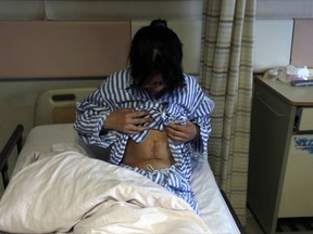 In this Wednesday, May 15, 2013, file photo, 28 year old Fang Hui shows off the scar from a living donor organ transplant operation where she received a portion of her sister's liver, at a hospital in Hangzhou in eastern China's Zhejiang province.
