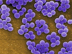 Scanning electron micrograph (SEM) shows a strain of Staphylococcus aureus  bacteria taken from a vancomycin intermediate resistant culture (VISA).