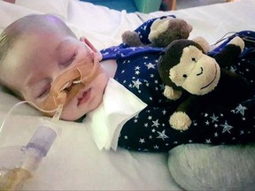 This is an undated photo of sick baby Charlie Gard provided by his family, taken at Great Ormond Street Hospital in London.