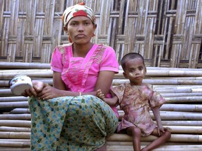 In this Friday, March 17, 2017, image made from video, Rosmaida Bibi, right, who suffers from severe malnutrition, sits with her 20-year old mother Hamida Begum outside their makeshift shelter at the Dar Paing camp, north of Sittwe, Rakhine State, Myanmar. Rosmaida Bibi looks a lot like any of the underfed 1-year-olds in a squalid camp for Myanmar's displaced ethnic Rohingya minority - but she's 4. She cannot grow, and her mother can't find anyone to help her because authorities won't let Rohingya leave the camp. (AP Video)