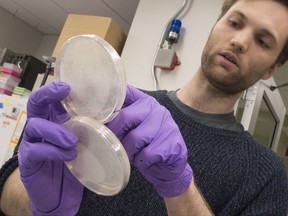 In this Tuesday, April 25, 2017 photo, assistant research technician Henri Berger, talks about live yeast cultures at a New York University lab in the Alexandria Center for Life Sciences in New York, where researchers are attempting to create completely man-made, custom-built DNA. The yeast genome is like a chain with 12 million chemical links, known by the letters, A, C, T and G. That's less than one-hundredth the size of the human genome, which has 3.2 billion links. (AP Photo/Mary Altaffer)