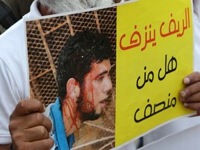 An activist shouts as he holds a placard in Arabic that reads "A protester asks the question is there a counsellor" during a demonstration in support of ongoing anti-government protests taking place in the northern Rif region, in Rabat, Morocco, Monday, July 20, 2017. Protests erupted in the northern town of Hoceima last year after the gruesome death of a fisherman, and have now developed into a social and economic movement. (AP Photo/Abdeljalil Bounhar)