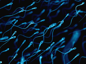 What matters most isn’t the number of sperm but their form and movement, one fertility expert says.