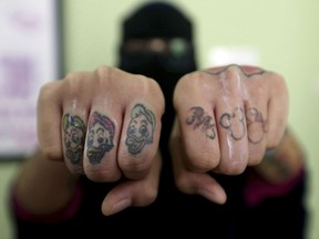 In this Aug. 11, 2017 photo, 19-year-old former tattooist Sri Novianti shows the tattoos on her fingers prior to a laser tattoo removal treatment at a clinic in Tangerang, Indonesia. Novianti who now wears a face covering veil wants her tattoos removed because they caused difficulties at her mosque whenever she performed ablutions before praying. "Many women seem shocked and cannot accept my presence because of my tattoos," she said. In addition to the religious prohibitions in Muslim-majority Indonesia, ideas about tattoos also reveal oppressive attitudes toward women, who if tattooed can be labelled as promiscuous or disreputable and not worth marrying. (AP Photo/Achmad Ibrahim)