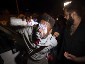 R.C. Maxwell flushes his eyes out after being pepper sprayed by mistake by a fellow Trump supporter after she was attacked by a counter protester during a demonstration on Main Beach in Laguna Beach Sunday August 20, 2017.