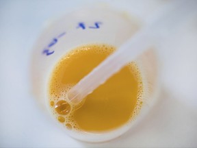 In this photo taken Monday, Aug. 7, 2017 an egg is being extracted with a pipette in a laboratory of the Chemical and Veterinary Investigation Office in Krefeld, Germany. Dutch investigators detained two men Thursday who are suspected of being involved in the illegal use of pesticide at poultry farms that sparked a massive food safety scare in several European countries. (Marcel Kusch/dpa via AP)