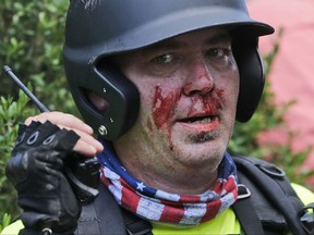 A white nationalist demonstrator, bloodied after a clash with a counter demonstrator, talks on the radio receiver at the entrance to Lee Park in Charlottesville, Va., Saturday, Aug. 12, 2017.