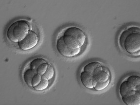 In this microscope photo provided by Oregon Health & Science University, human embryos grow in a laboratory for a few days after researchers used gene editing technology to successfully repair a heart disease-causing genetic mutation. The work, a scientific first led by researchers at Oregon Health & Science University, marks a step toward one day preventing babies from inheriting diseases that run in the family. (Oregon Health & Science University via AP)