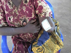 Undated photo provided by OHCHR in Geneva, shows a woman with amputated arm  in the province Lunda Norte, Angola in June 2017. U.N. human rights investigators have issued a report documenting the killings of more than 250 people, including 62 children, in violence in central Congo over three recent months that could devolve into "wider ethnic cleansing." The investigators based the report on interviews in June of 96 people who fled Congo's Kasai provinces into neighboring Angola. (OHCHR  via AP)